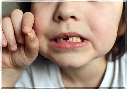 Baby teeth trauma: what to do?