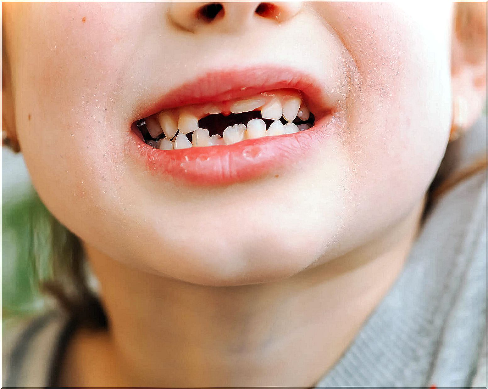 Baby teeth trauma: what to do?